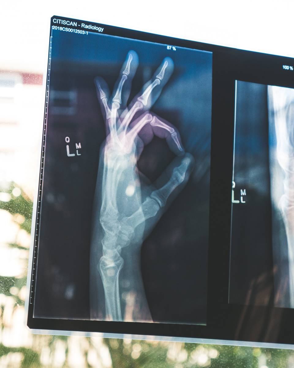 Improve healthcare by preventative scanning